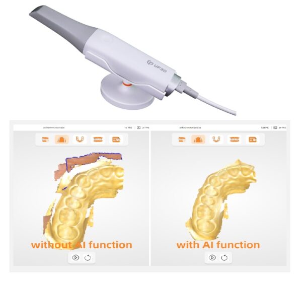 3D intraorálny skener - Image 4